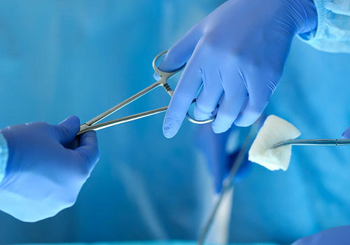 Cách trị trĩ dứt điểm chuẩn y khoa hiện nay