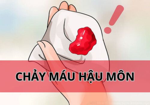 Chảy máu hậu môn: Cơ thể bạn đang cảnh báo bệnh lý gì?