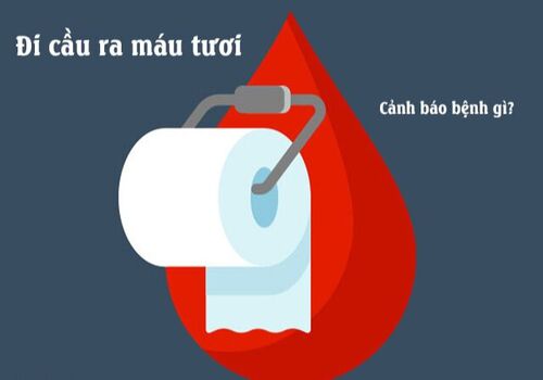 Ỉa ra máu tươi: Cơ thể đang “báo động” về vấn đề sức khỏe