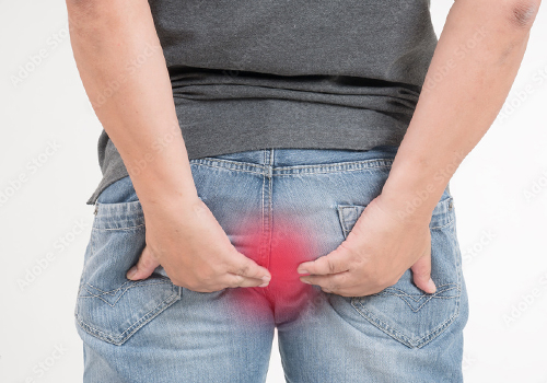 Khám trĩ ở đâu tốt nhất? Quy trình khám chữa bệnh trĩ