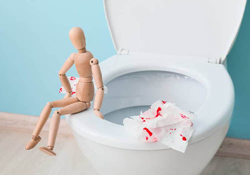 Đi vệ sinh ra máu tươi là bệnh gì? Nguyên nhân và cách điều trị
