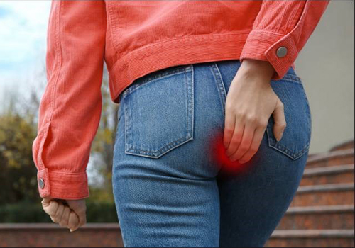 Vì Sao Bị Trĩ? Nguyên Nhân Và Cách Phòng Tránh Bệnh Trĩ