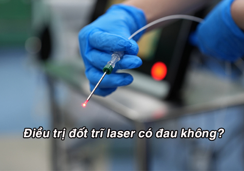 Giải đáp: Điều trị đốt trĩ laser có đau không?