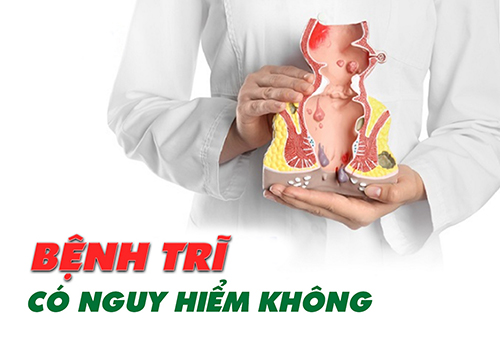 Bệnh trĩ có nguy hiểm không? Lắng nghe bác sĩ chia sẻ