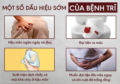 Các dấu hiệu của bệnh trĩ: Làm sao để nhận biết sớm và điều trị?